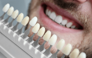 what to do if you think you have an infection after dental veneers